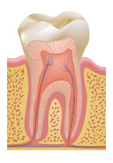 Endodontic Retreatment Dr. Wolfson